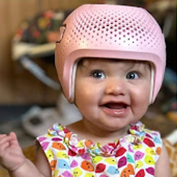 Smiling baby wearing a pink cranial helmet and a colorful fruit-print dress indoors