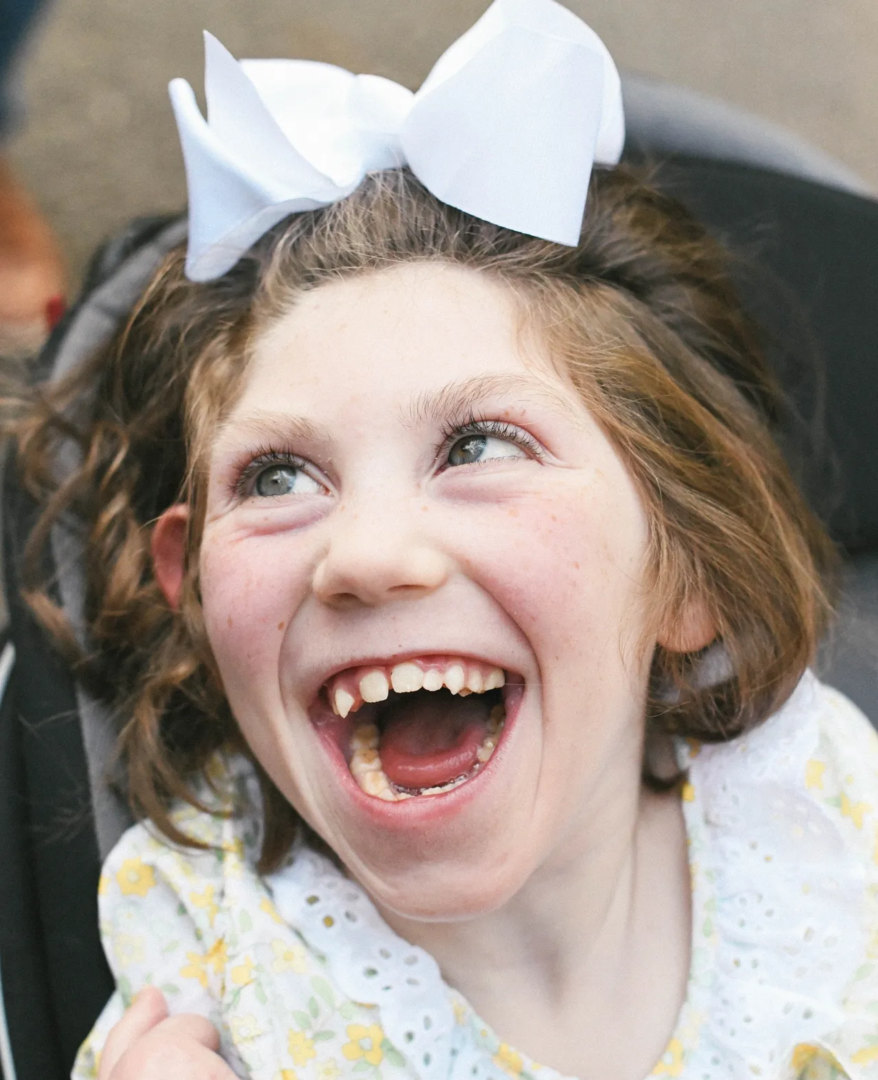 Close-up of a joyful child with a large white hair bow laughing, wearing a floral dress with a lace collar.